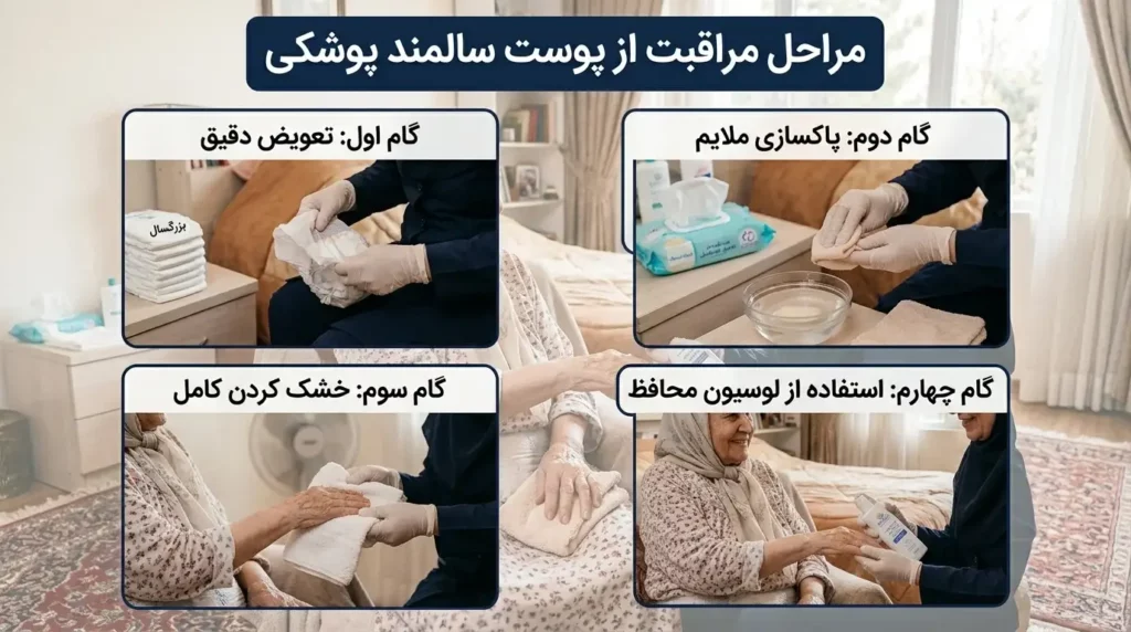 مراحل مراقبت از پوست سالمند پوشکی